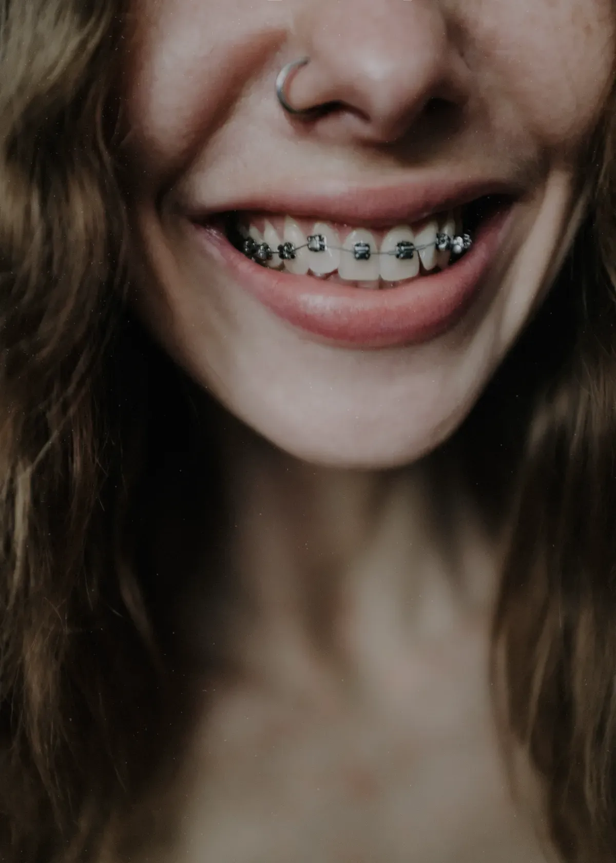 Best Toothpaste For Braces Top 5