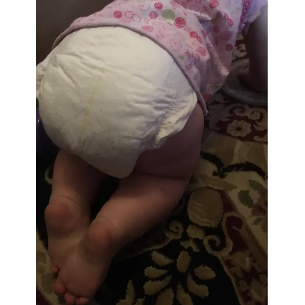 Diapers For Sensitive Skin